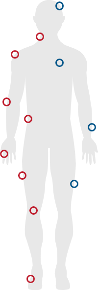 Lakeshore Bone & Joint Orthopedic Urgent Care | Outline of a human body with marked points in red and blue on the shoulders, elbows, hands, hips, and knees.